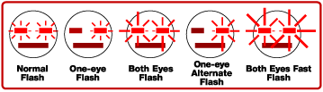 There are 5 different types of flashing.